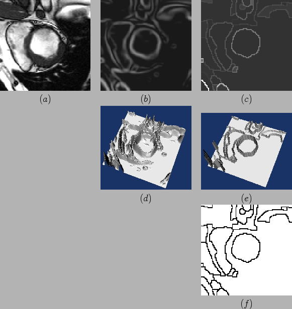 \begin{figure}\begin{center}
\begin{tabular}{c c c}
\epsfig{figure=/home/coust...
...tat_r.ps,width=4.0cm}\\
& &$(f)$
\end{tabular}\par\end{center}\end{figure}